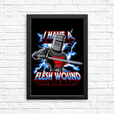 I Have a Flesh Wound - Posters & Prints